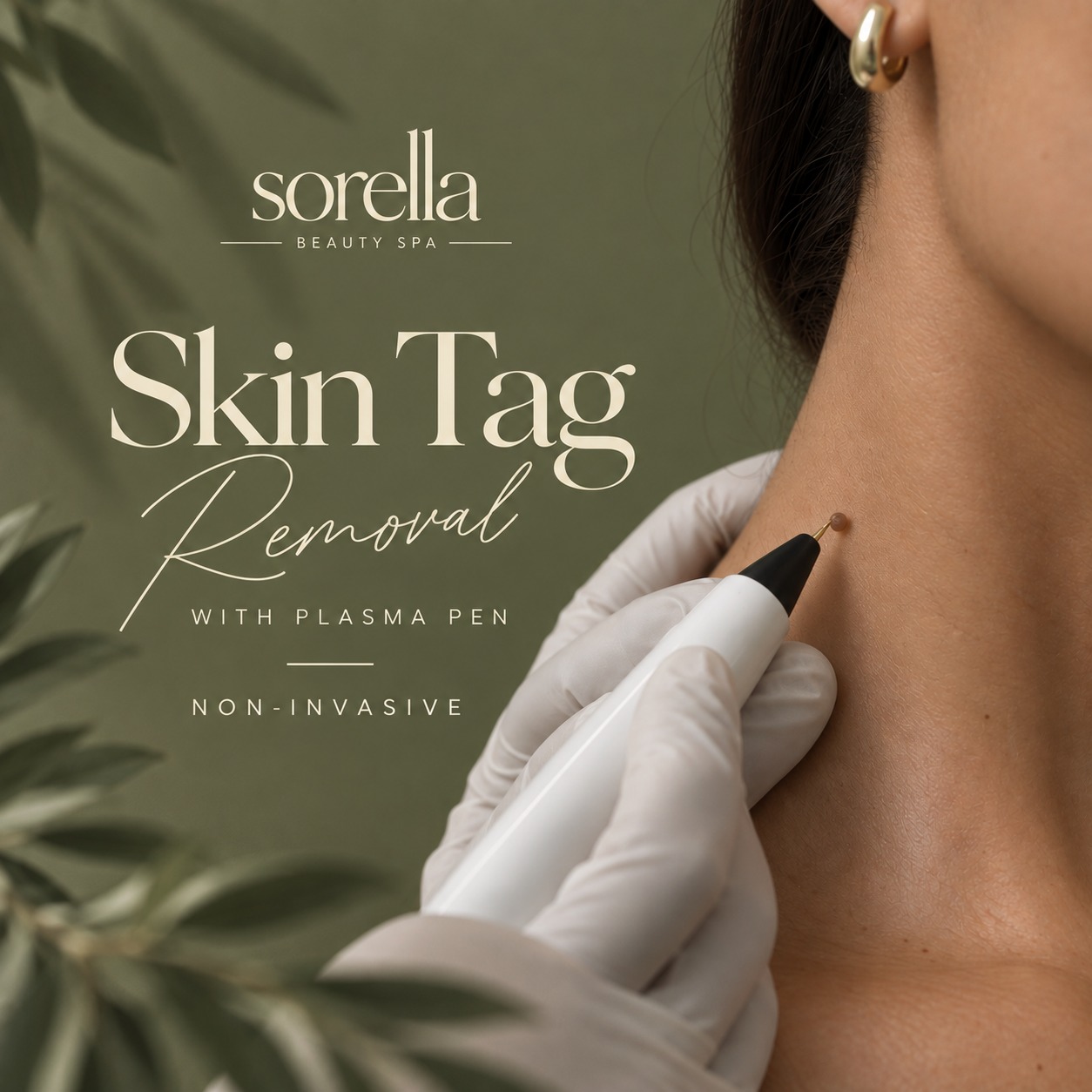 Skin tag removal treatment at Sorella Beauty Spa
